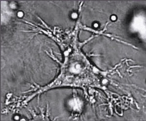 Nanopartikel um und in einer Nervenzelle